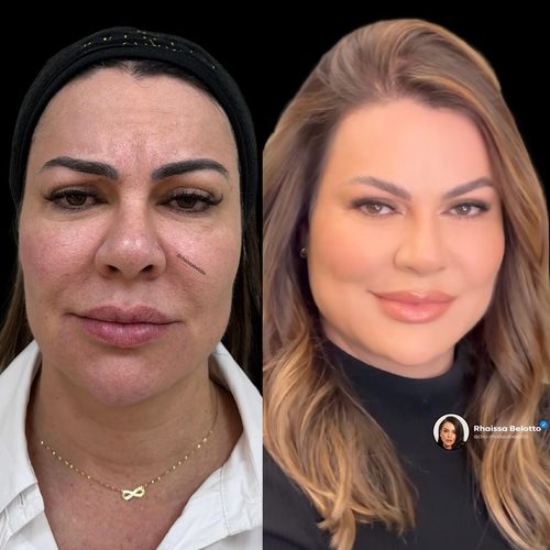 Full face result example