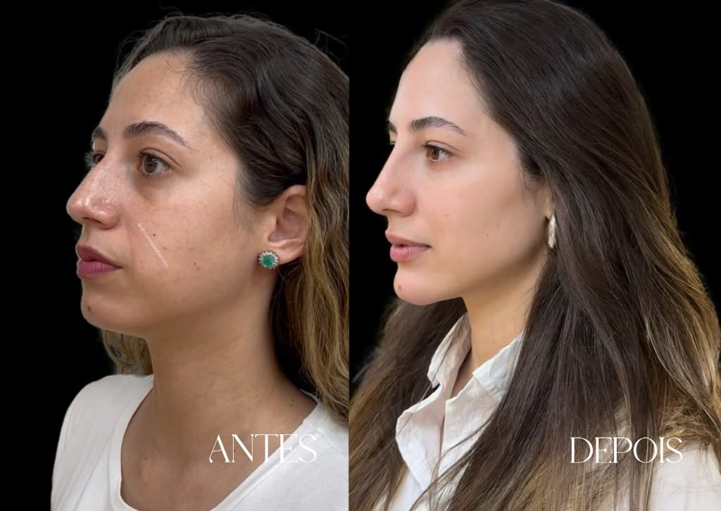 FullFace result, before and after